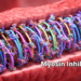 New myosin inhibitors reshape treatment of obstructive hypertrophic cardiomyopathy