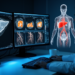 Liver fat on spectral CT links to coronary plaque danger signs in chest pain patients
