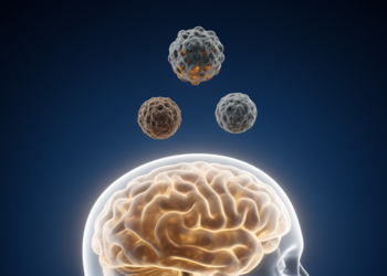 Three PM2.5 Chemicals Emerge as Prime Suspects in Age-Related Cognitive Decline