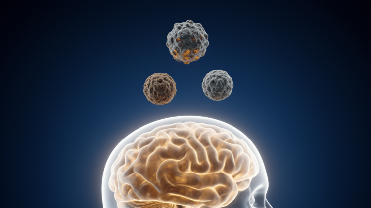 Three PM2.5 Chemicals Emerge as Prime Suspects in Age-Related Cognitive Decline