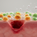 Biofilms Drive Diabetic Foot Ulcer Chronicity, Review Finds, but New Therapies Emerge