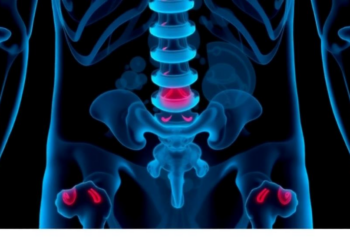 Rare Penile Metastasis From Prostate Cancer Slips Past PSA Screening