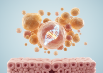 Seven-case study maps the morphology of ETV6::NTRK3-fused thyroid cancer