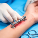 First-in-human wrist implant with two rotation centers shows early stability in five patients