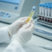Blood protein signatures may hint at which rheumatoid arthritis drug will work first