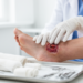 Liraglutide speeds diabetic foot ulcer healing in randomized trial