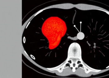 AI Reads Routine CT Scans to Tell Dangerous Adrenal Tumors from Harmless Ones