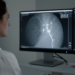 AI Spots Breast Artery Calcifications on Routine Mammograms with High Specificity but Modest Sensitivity