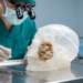 Research report: Giant Central Ossifying Fibroma of the Anterior Maxilla and Maxillary Sinus With Orbital Floor Extension: A Case Report