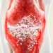 Synovitis severity may steer JAK inhibitor response in difficult-to-treat rheumatoid arthritis