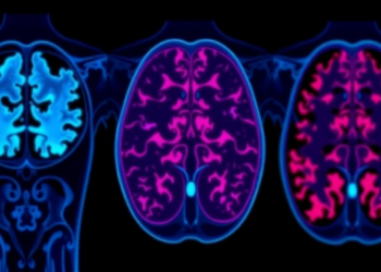 PET-Based Metabolic Score Outperforms Standard Risk Model in Lymphoma Patients