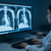 Volume Doubling Time Emerges as Decisive Imaging Biomarker in Lung Cancer Screening Debate
