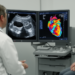 Heart scans disagree in cancer patients: ejection fraction and strain often diverge