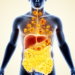 High serum urate linked to visceral and liver fat in obesity study