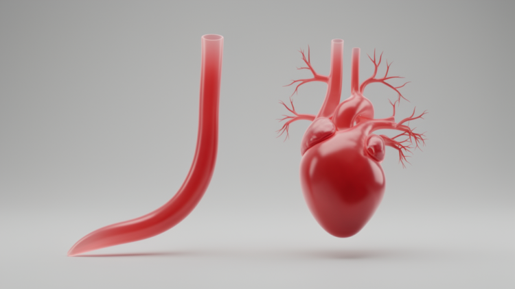 Sudanese Angiography Study Finds Women’s Coronary Arteries Are Longer and More Tapered Than Men’s