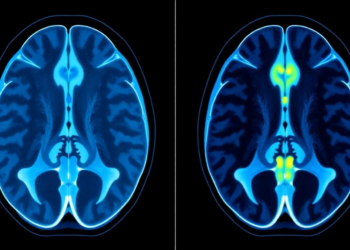 Muscle fat-free area on lumbar MRI outperforms VBQ score for osteoporosis detection