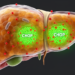Stress protein CHOP shields the liver from acetaminophen damage, mouse study finds