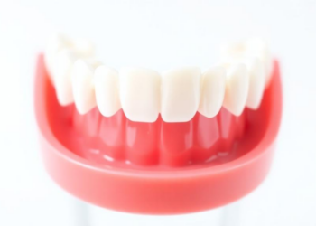 Invisalign Aligners Fall Short on Extrusion and Tipping, Study Finds