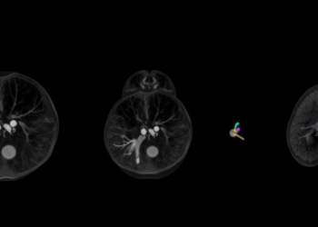 From small 1997 initiative to one of Europe’s largest breast imaging societies