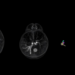 From small 1997 initiative to one of Europe’s largest breast imaging societies