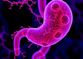 Gut Microbe Veillonella Emerges as a Potential Driver of Pancreatic Cancer Progression