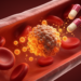 Suspected HIV drug resistance linked to raised inflammation and altered clotting in Kenya