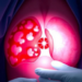 Emergency Embolization Halts Life-Threatening Bleeding from Advanced Breast Tumor