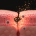Pneumonia may lead to sepsis through a failing immune boundary, researchers argue