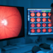 Inception-V3 transfer learning grades diabetic retinopathy severity with 93.45% accuracy
