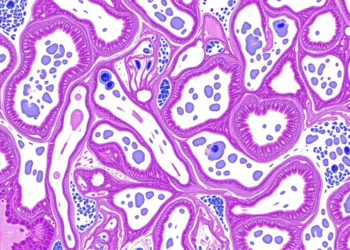AI Reads Routine Pathology Slides to Predict Cancer Biomarkers Across 12 Tumor Types