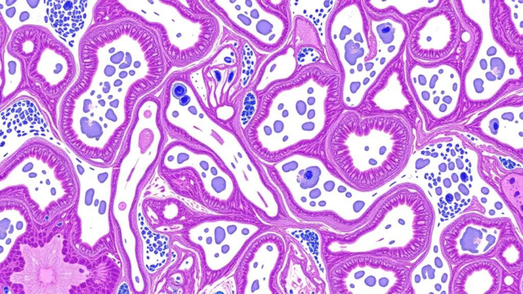 AI Reads Routine Pathology Slides to Predict Cancer Biomarkers Across 12 Tumor Types