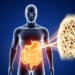 Body shape indices linked to bone loss in diabetes and prediabetes, NHANES analysis finds