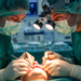 Surgeons map final venous outflow routes in submental island flap reconstruction