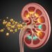 Berberine Eases Diabetic Kidney Damage by Tuning a Renal Sugar-Transport Switch