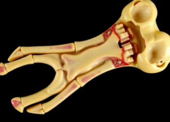 Scientists Crack the Code for Staining Human Bone Without Fixing, Decalcifying or Embedding It