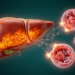 Iron Overload, Ferroptosis and the Liver: Mapping a Deadly Network
