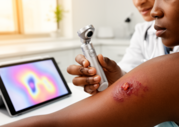 Explainable AI Could Help Diagnose Neglected Tropical Diseases in Darker Skin, Review Finds