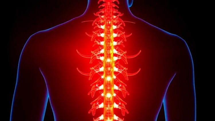 Laser Therapy Offers New Hope for Rare Spinal Tumors When Surgery Runs Out of Options