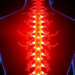 Laser Therapy Offers New Hope for Rare Spinal Tumors When Surgery Runs Out of Options