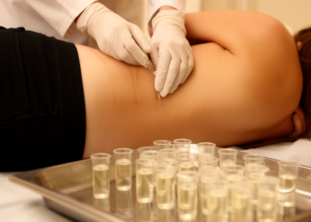 Cerebrospinal Fluid Analysis: From Lumbar Puncture Technique to Clinical Biomarker Interpretation