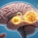 Research report: Fatty acid metabolism in glioma: a review of novel targets and therapeutic strategies