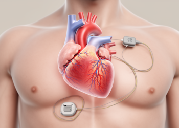 Right-Sided Heart Pacemaker Lead With Chest Tunneling Offers Salvage When Main Vein Is Blocked