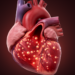 ICI Myocarditis Complicated by HOCM and NSTEMI in Cancer Patient