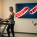 Weight Loss Improves Vascular Health in Obesity Only When Sleep Apnea Is Mild or Absent