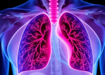 Persistent Emotional Distress Tracks With Poorer Survival in Lung Cancer Patients Undergoing Neoadjuvant Therapy and Surgery