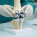Knee Subluxation Before Surgery Does Not Worsen Two-Year Results of Partial Knee Replacement