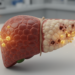 Quercetin Plus Low-Dose Gamma Rays Curbed Chemically Induced Liver Cancer in Rats