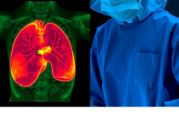 Active Thermal Imaging Spots Residual Breast Cancer During Surgery in 90 Seconds
