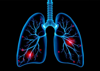 AI Plans Safer Needle Paths for Lung Biopsies, Feasibility Study Finds