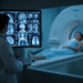 PET scans before chemotherapy may predict response in breast cancer patients